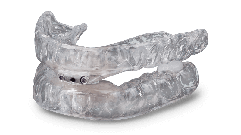 TAP oral appliance for snoring and sleep apnea