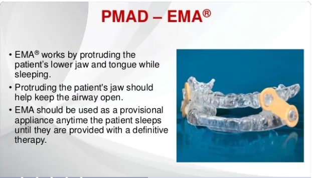 EMA Dental Device for Snoring and Sleep Apnea Treatment PMAD