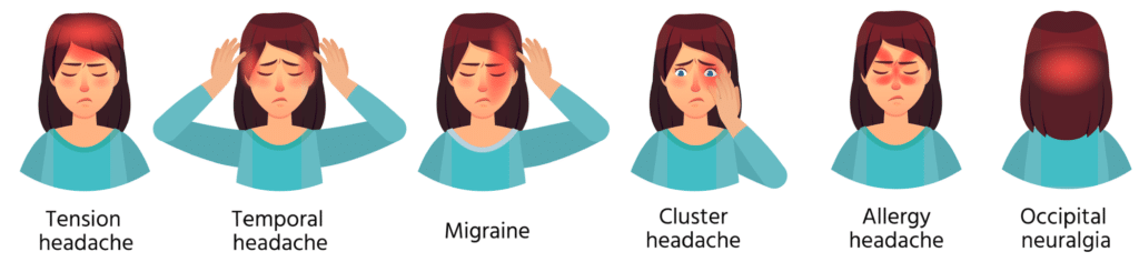 Tension Headache, Temporal Headache, Migraine, Cluster Headache, Allergy Headache,Occipital Neuralgia